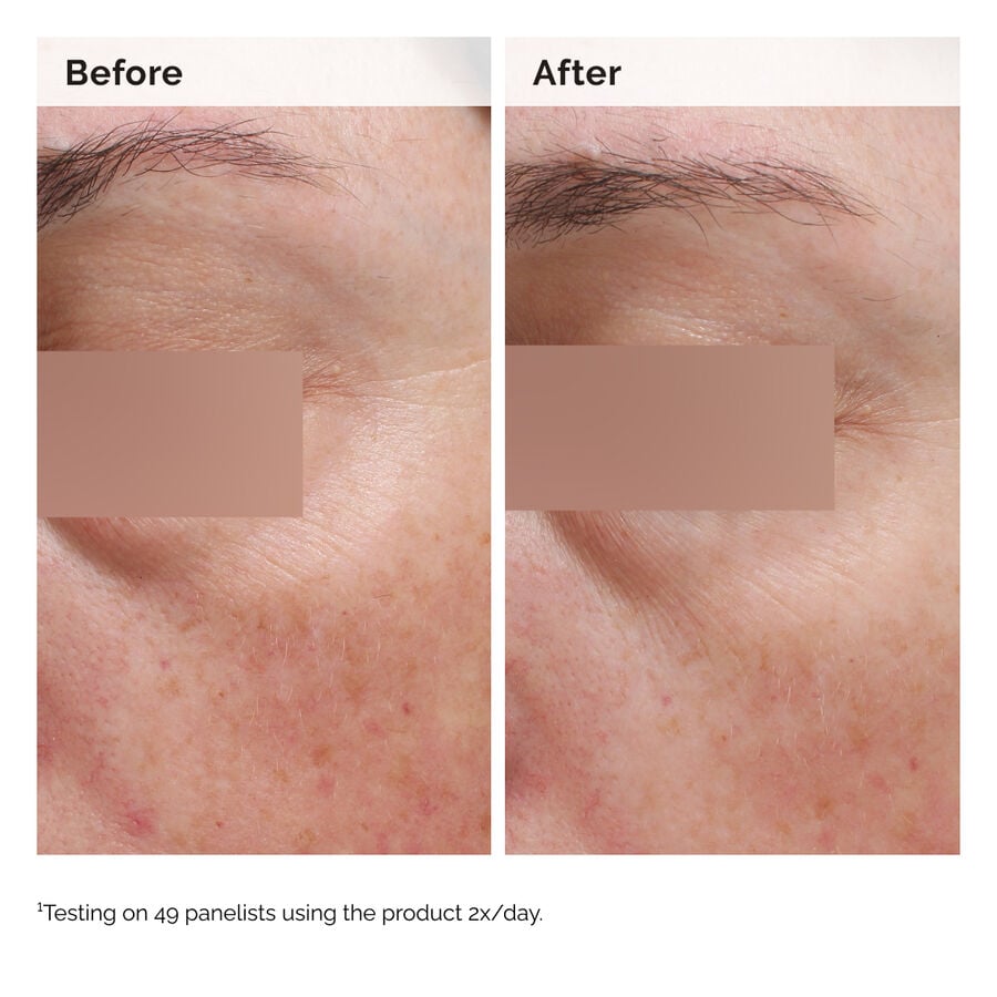 niacinamide-5-face-and-body-emulsion-y1 2024-08-23-ORD-Nia-5pct-Face-Body-B-A-Elasticity-Global-02-1x1.jpg