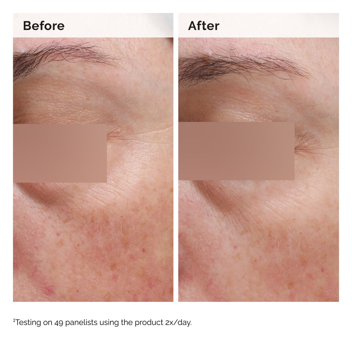 niacinamide-5-face-and-body-emulsion-y1 2024-08-23-ORD-Nia-5pct-Face-Body-B-A-Elasticity-Global-02-1x1.jpg