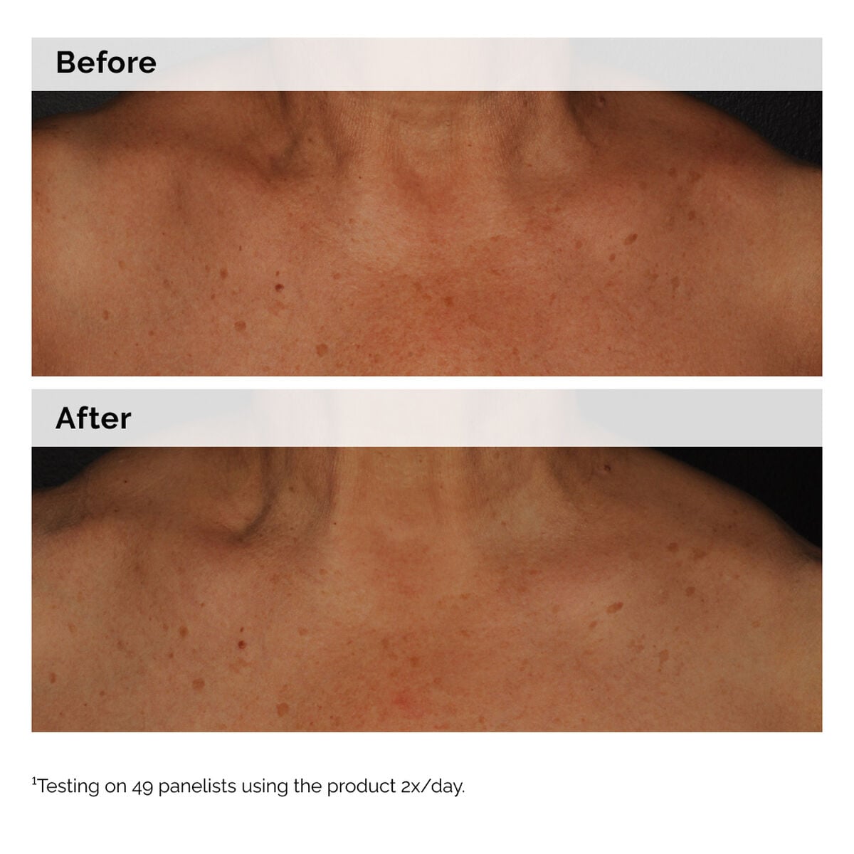 niacinamide-5-face-and-body-emulsion-y1 2024-08-23-ORD-Nia-5pct-Face-Body-B-A-Global-02-1x1.jpg