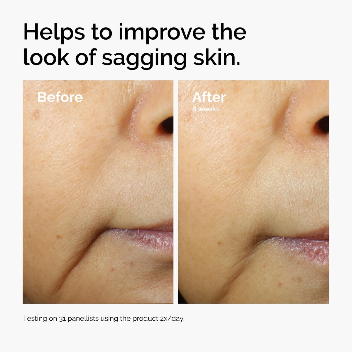 caffeine-3-escin-1-face-serum-c4 ord-caffeine-3pct-escin-1pct-face-serum-before-after-sagging.jpg