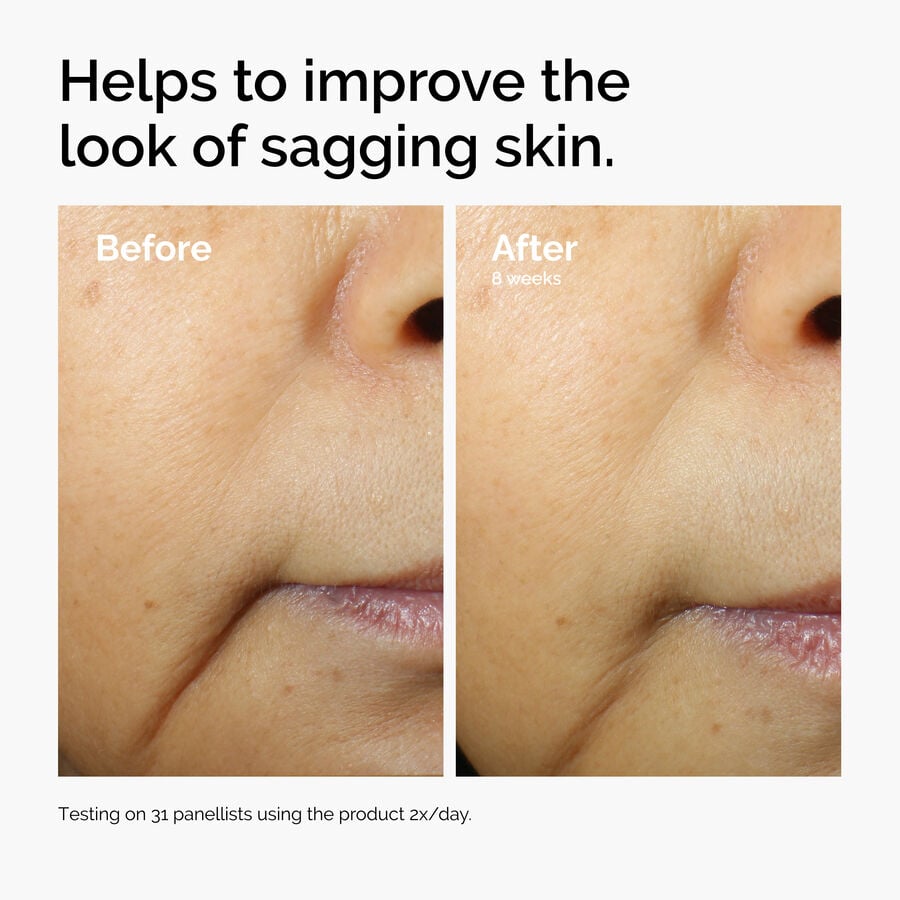 caffeine-3-escin-1-face-serum-c4 ord-caffeine-3pct-escin-1pct-face-serum-before-after-sagging.jpg
