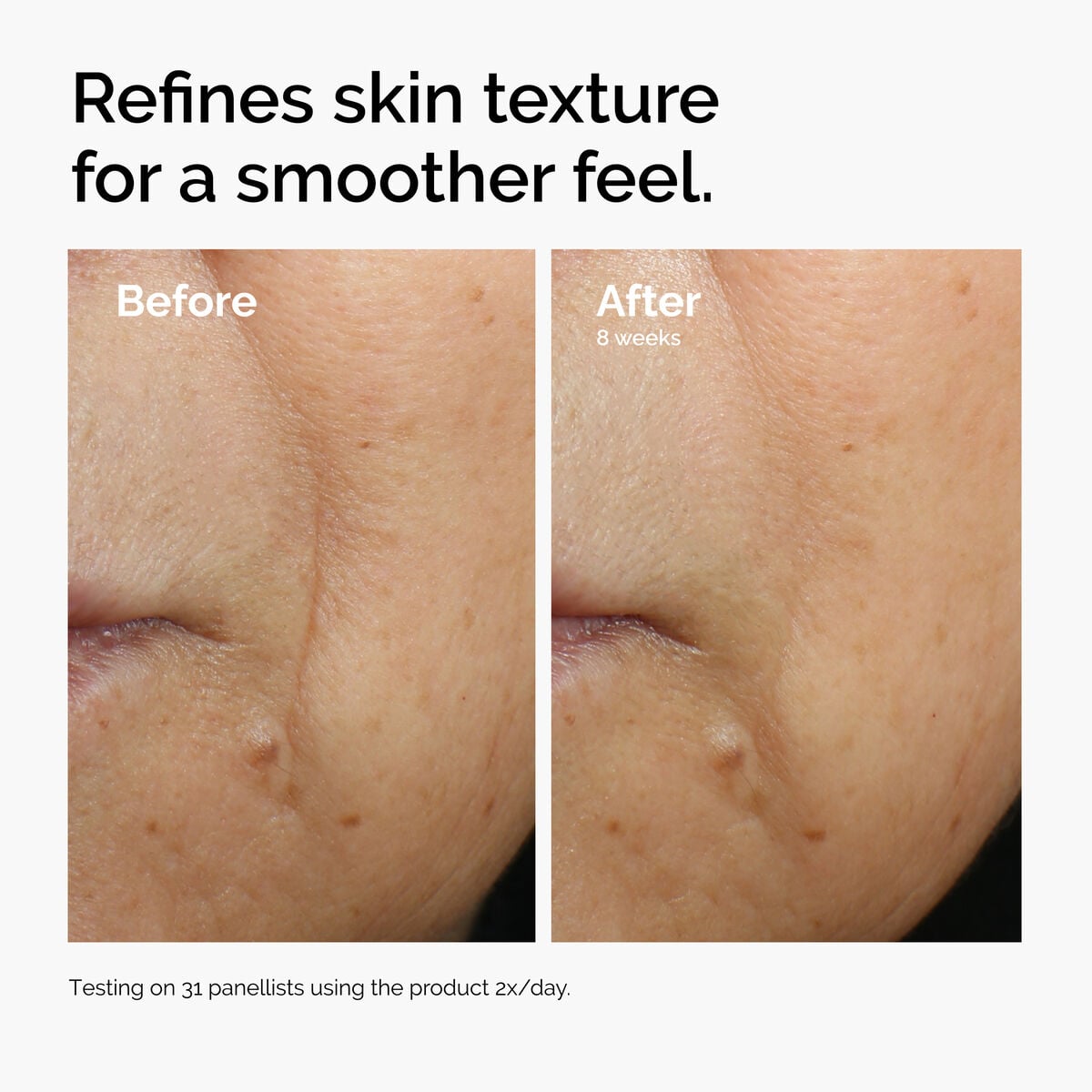 caffeine-3-escin-1-face-serum-c4 ord-caffeine-3pct-escin-1pct-face-serum-before-after-texture.jpg