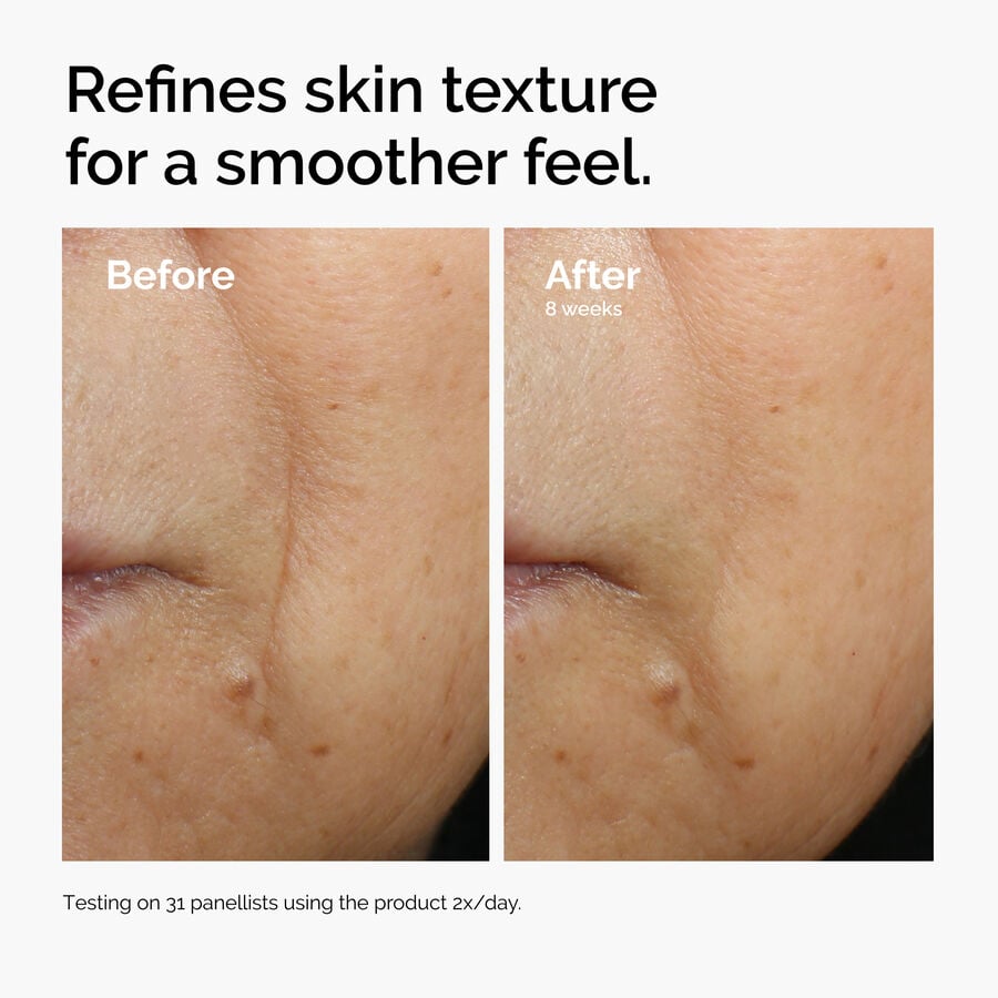 caffeine-3-escin-1-face-serum-c4 ord-caffeine-3pct-escin-1pct-face-serum-before-after-texture.jpg