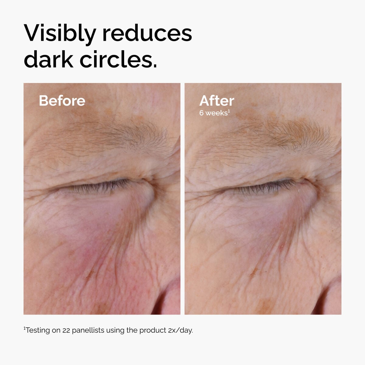 caffeine-solution-5-egcg-eye-serum-z7 ord-caffeine-solution-egcg-dark-circles-before-after.jpg