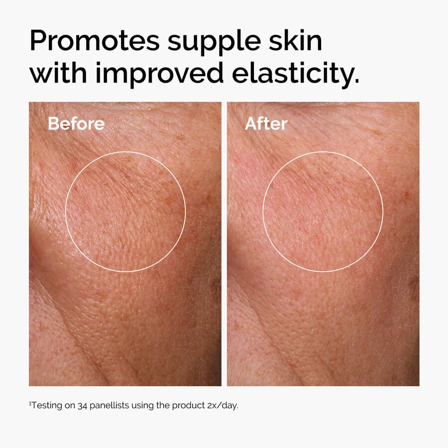 hyaluronic-acid-2-b5-with-ceramides-k9 ord-hyaluronic-acid-2pct-b5-hydrating-serum-before-after-elasticity.jpg