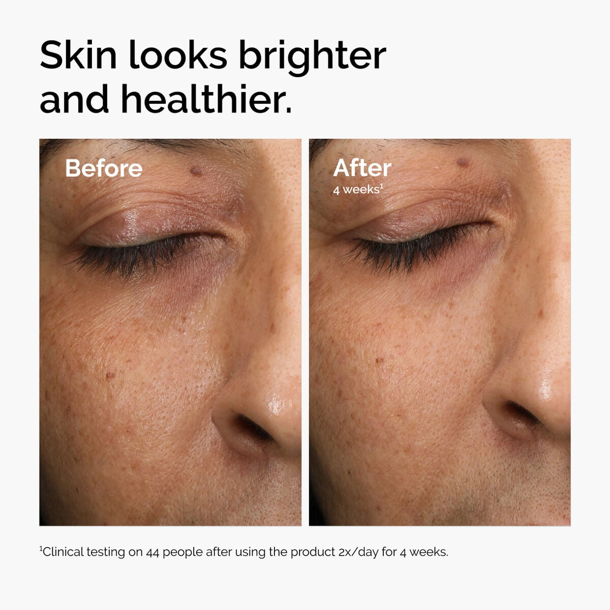 multi-antioxidant-radiance-serum-s6 ord-mars-before-after-healthy.jpg