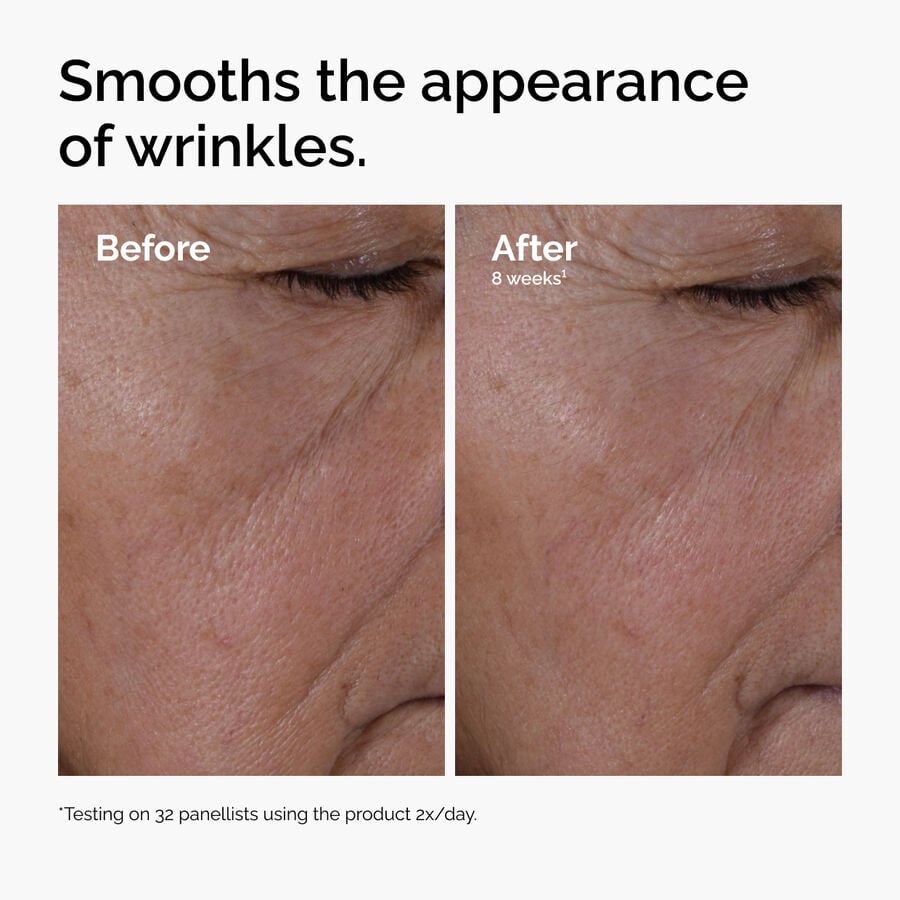 multi-peptide-ha-serum-q0 ord-multi-peptide-ha-serum-wrinkles-before-after.jpg