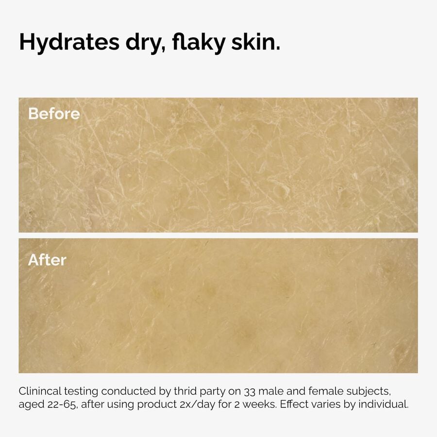 the-body-care-collection-v3 ord-natural-moisturizing-factors-inulin-body-before-after-graphic-02.jpg